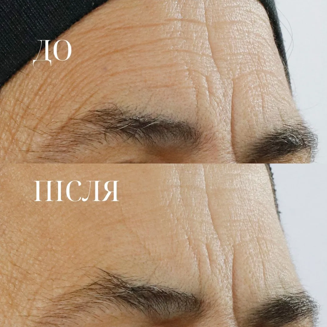 Сироватка з потрійним ретинолом