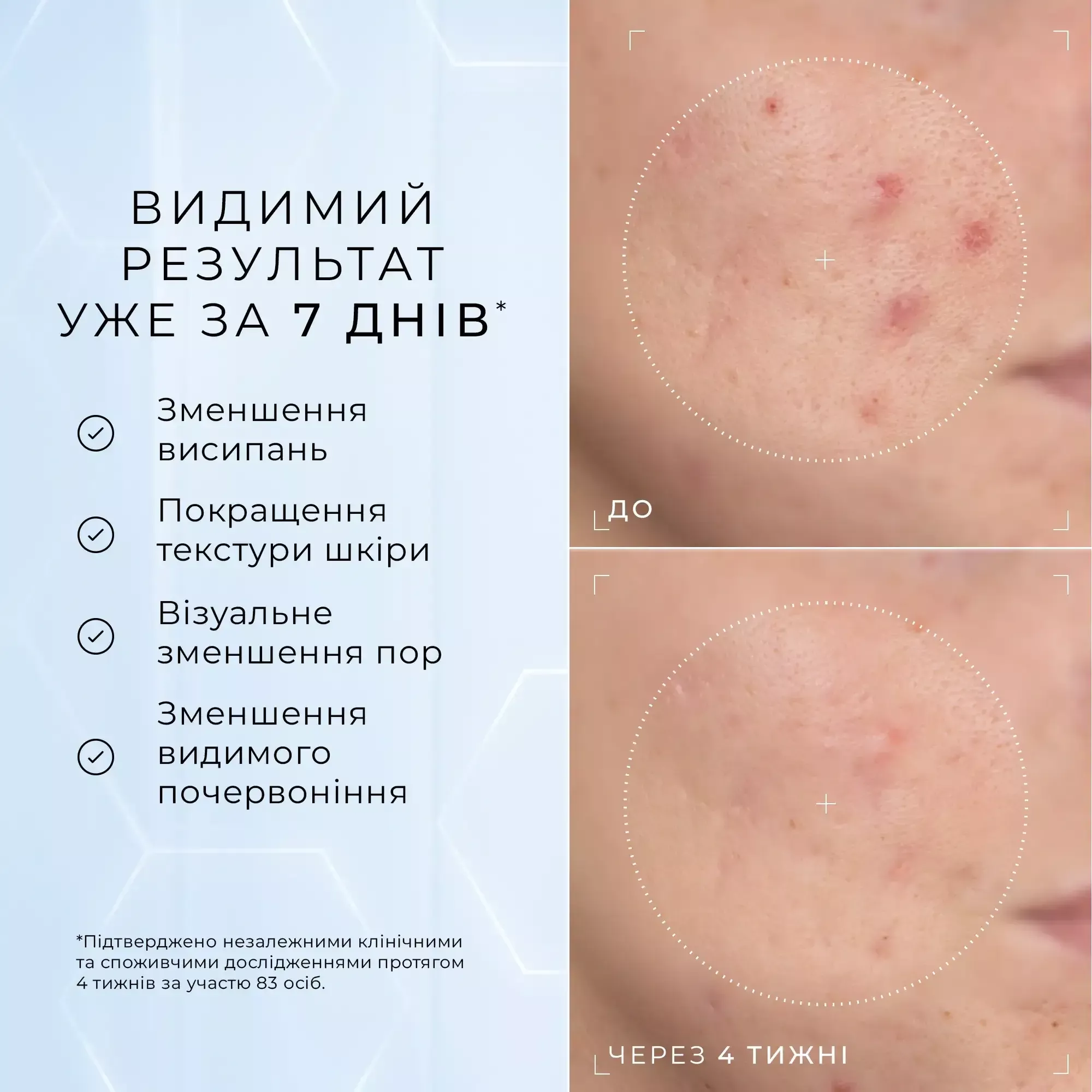 Сироватка з 10% ніацинамідом та пептидами